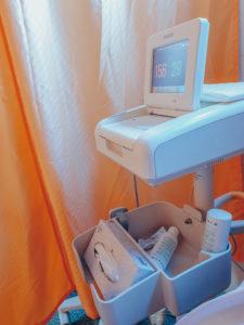 Amenaza de parto prematuro - mi experiencia - monitores de contracciones y frecuencia cardiaca fetal